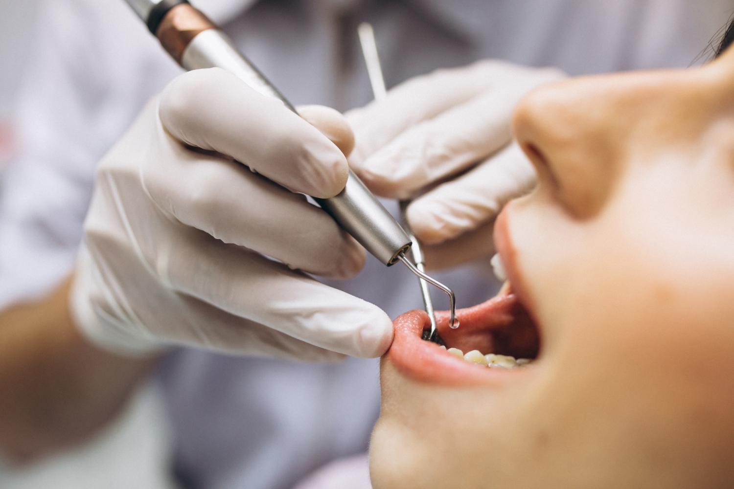 מה שצריך לדעת על טיפולי שיניים ובריאות הפה